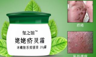 治疗疥疮最好的药膏